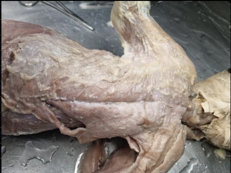 肌肉纤维识别数据集-YOLO数据集
